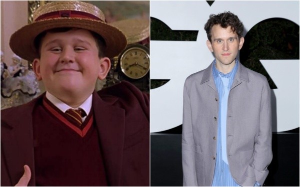 El admirable cambio físico de Harry Melling. 
